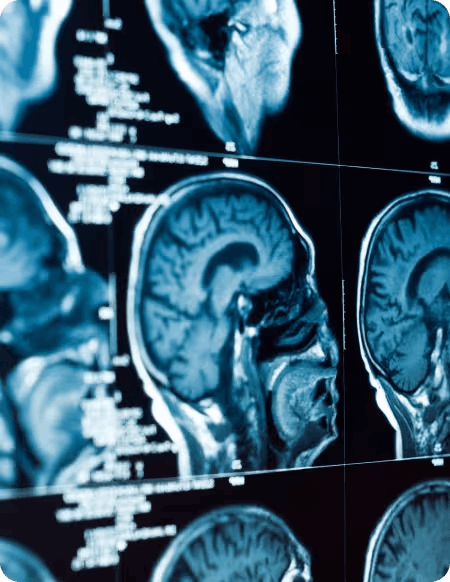 neurovera™
